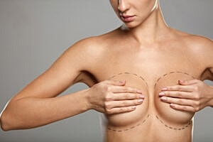 Do I Need a Breast Lift After Breast Augmentation Surgery?
