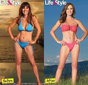 Original Bachelorette Reveals Post Plastic Surgery Body