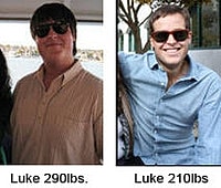 Teenage Gynecomastia