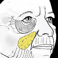 The Benefits of Having a Facelift in Your 40’s-50’s