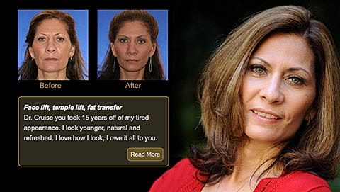 The Custom Face Lift Approach To Facial Aging