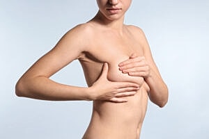 Understanding the Degrees of Breast Sagginess