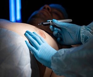 What Areas of the Body Can Men and Women Get Liposuction?