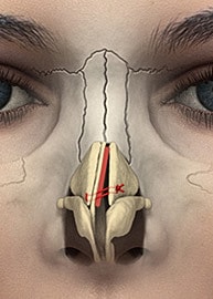 Anatomical illustration of human nasal structure.