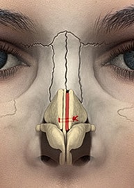 Anatomical illustration of a human nose structure.