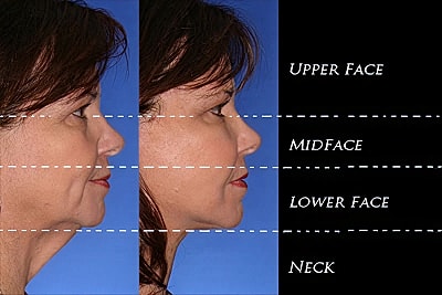 Facial anatomy sections labeled from side view.