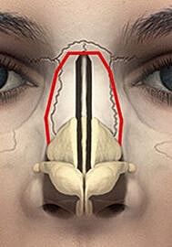 Anatomical illustration of human nasal structure.