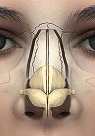 Illustration of nasal anatomy and septum structure.