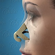 Nose surgery illustration with design elements