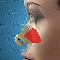 Nose anatomy illustration with highlighting sections.
