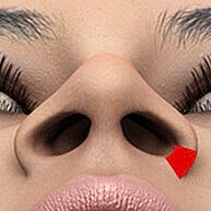 Close-up of a nose with highlighted feature.