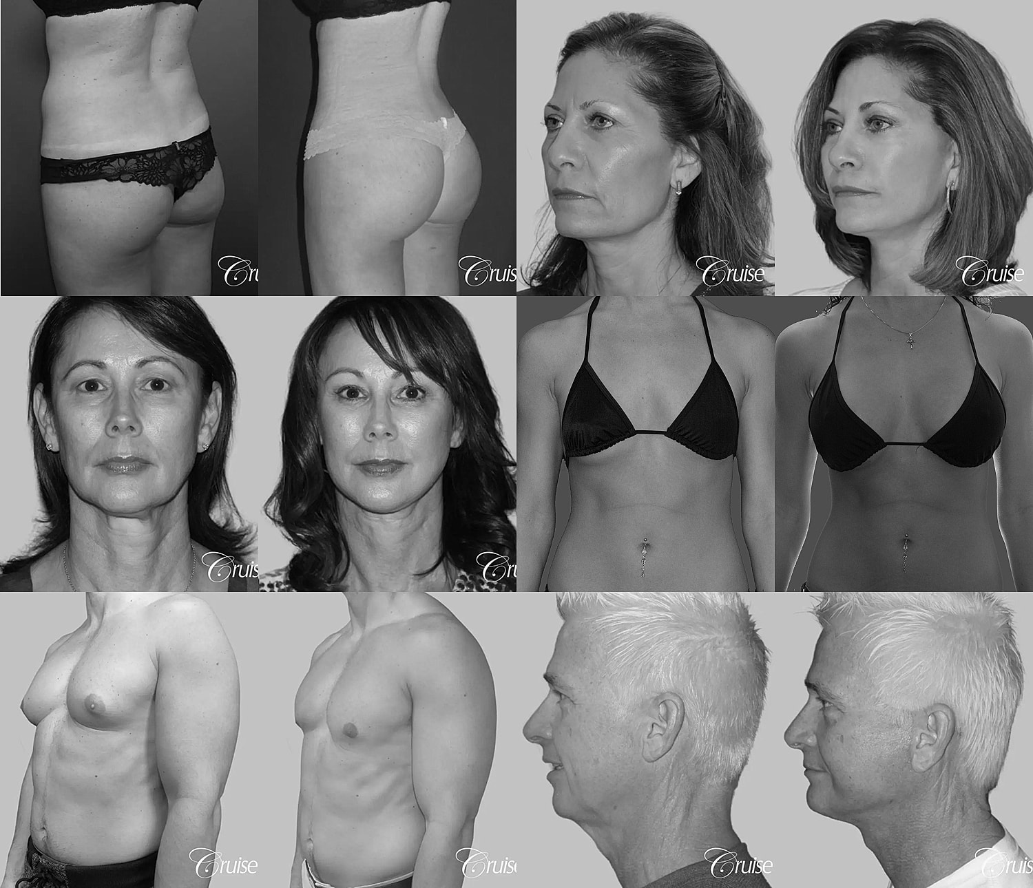 Before and after cosmetic surgery transformations.