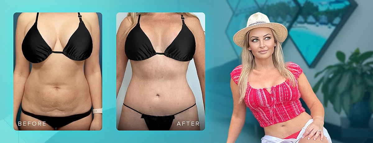 Before and after body transformation comparison.