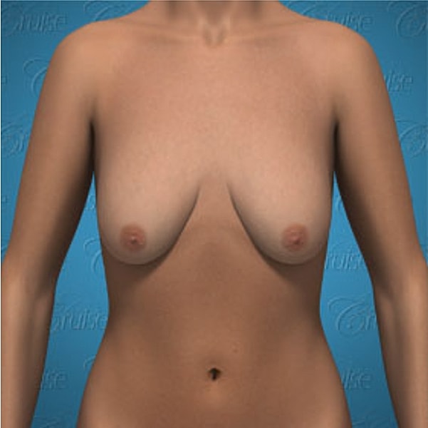 3D rendering of a female torso.