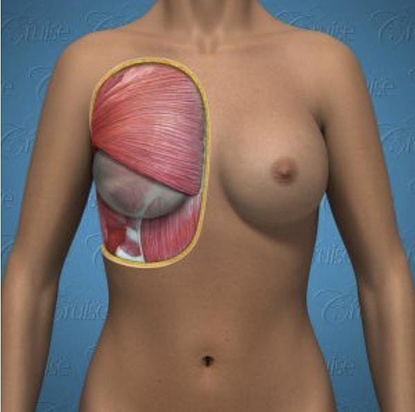 Anatomical illustration of breast and muscle structure.