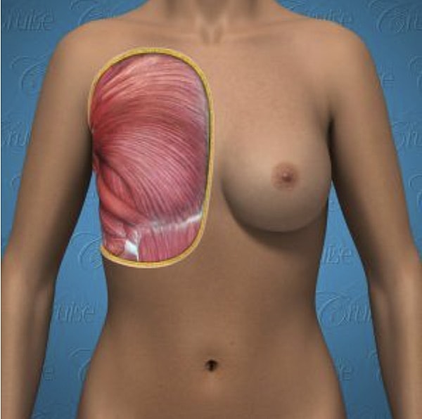 Anatomical illustration of human chest muscles.