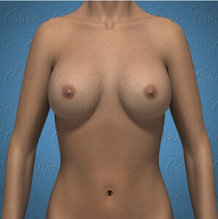 Anatomically illustrated female torso front view.