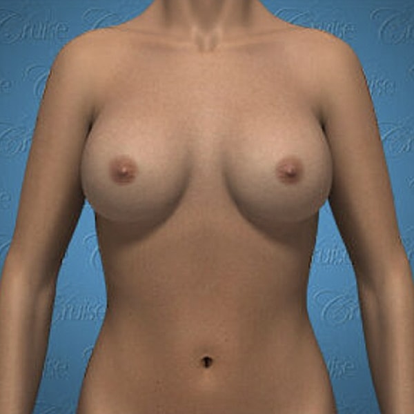 3D model of female torso and breasts.