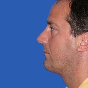 Side profile of a man against blue background.