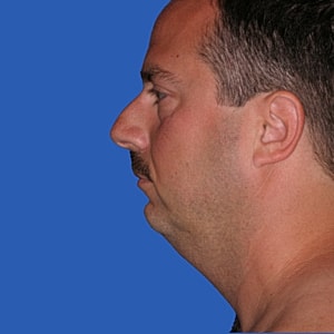 Man's profile against a blue background.
