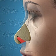 Illustration of a nose anatomy diagram.