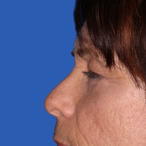 Profile view of a woman against blue background.