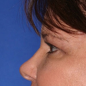 Profile view of a woman against blue background.