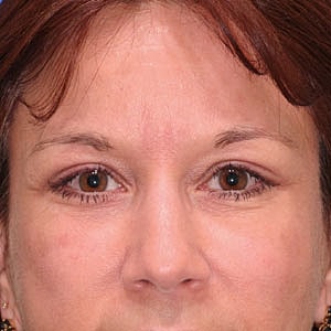Close-up of a woman's face and eyes.