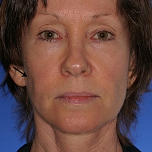 Woman with short hair and neutral expression.