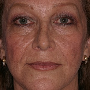 Close-up portrait of a mature woman.