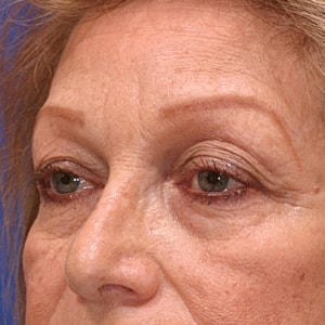 Close-up of woman's face with subtle aging signs.