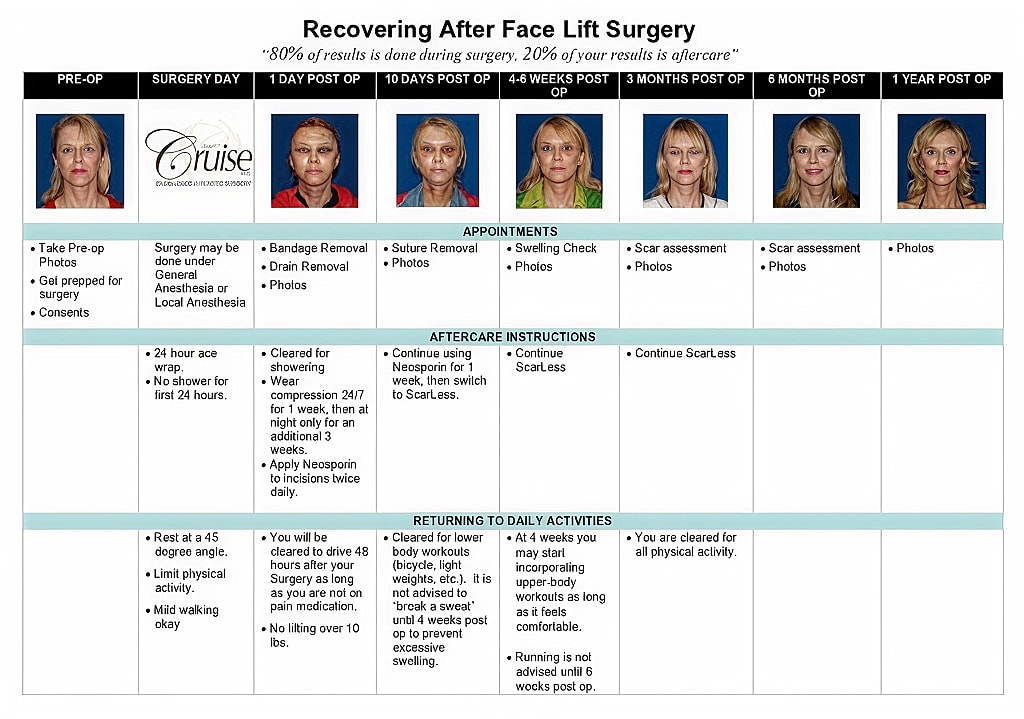 Face lift surgery recovery timeline and instructions.