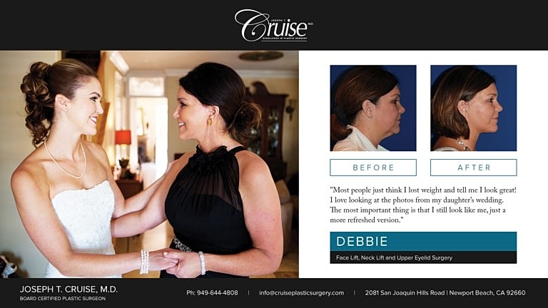 Before and after plastic surgery transformation.