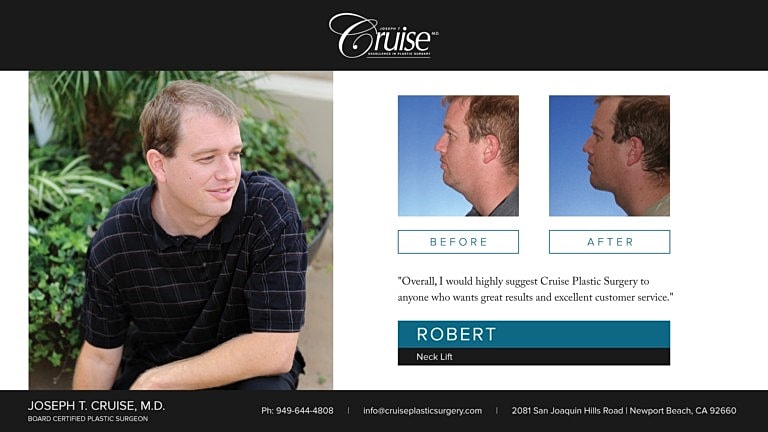 Before and after neck lift transformation.