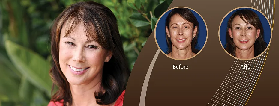 Before and after cosmetic procedure comparison.