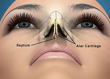 Nasal anatomy showcasing septum and alar cartilage.