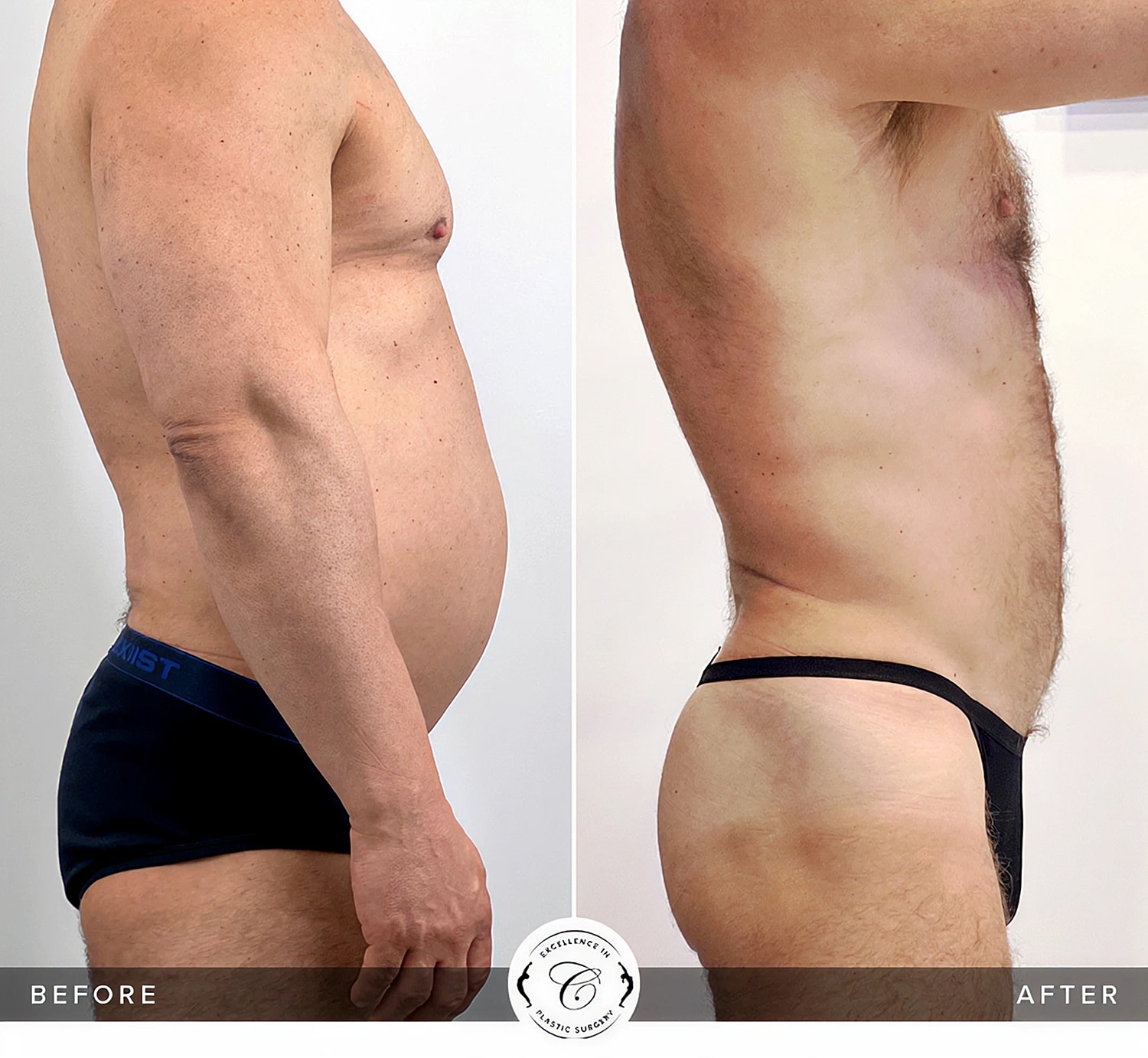 Before and after body transformation side view.