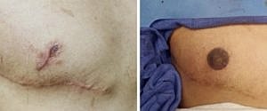 Post-surgical skin images showing scars and markings.