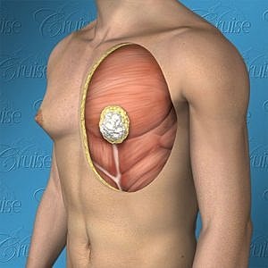 Anatomical illustration of human chest muscles.