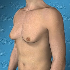 Male torso side view against blue background.