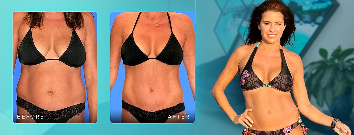 Before and after body transformation image.