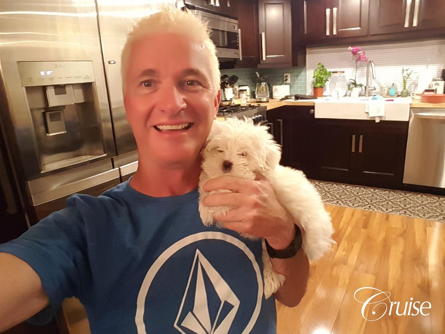 Neck Lift Before & After