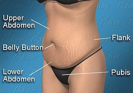 Anatomy illustration of abdominal areas and landmarks.
